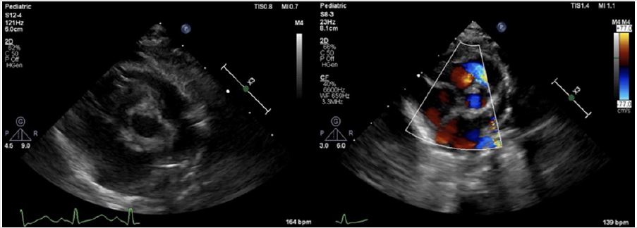 biomedres-openaccess-journal-bjstr