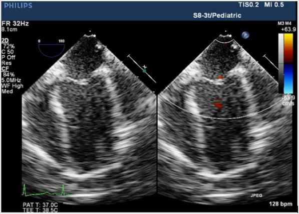 biomedres-openaccess-journal-bjstr
