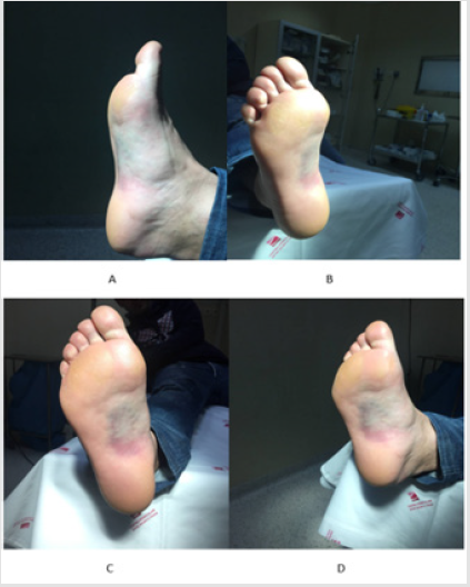 biomedres-openaccess-journal-bjstr