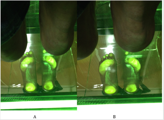 biomedres-openaccess-journal-bjstr