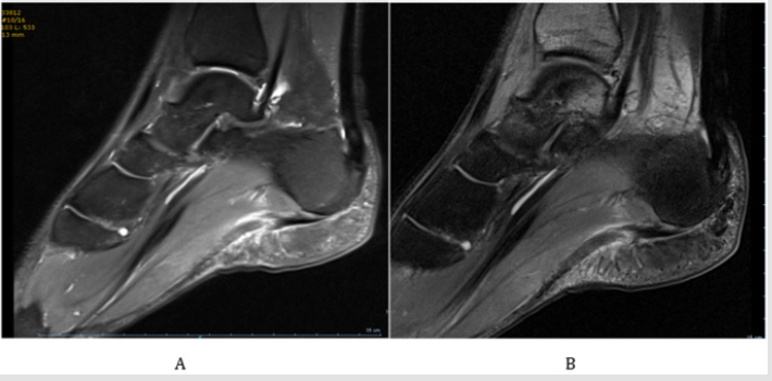 biomedres-openaccess-journal-bjstr