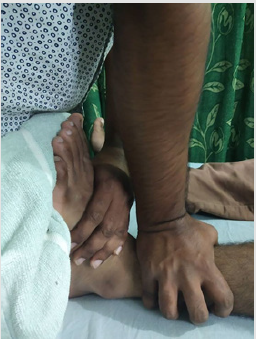 biomedres-openaccess-journal-bjstr