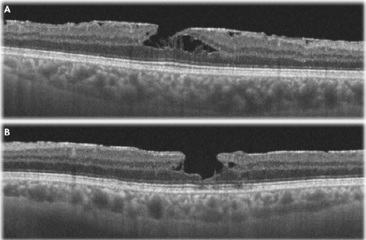 biomedres-openaccess-journal-bjstr