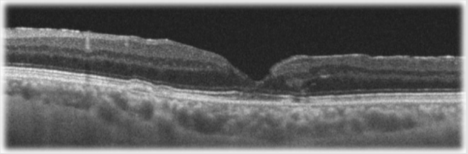 biomedres-openaccess-journal-bjstr