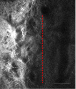 biomedres-openaccess-journal-bjstr
