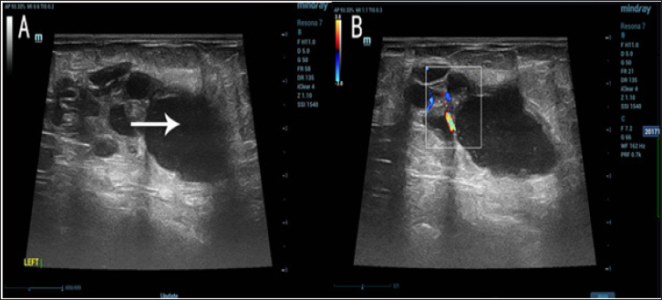 Click here to view Large Figure 1