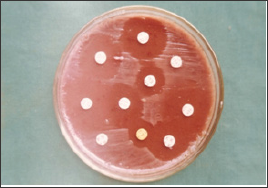 Click here to view Large Figure 1