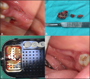 Click here to view Large Figure 1