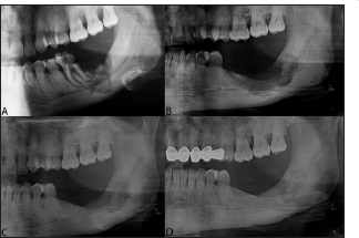 Click here to view Large Figure 2