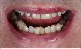 Click here to view Large Figure 2