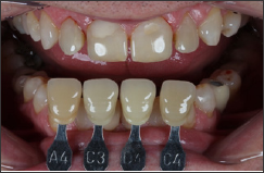 Click here to view Large Figure 3