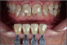 Click here to view Large Figure 4