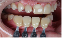 Click here to view Large Figure 5