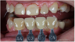 Click here to view Large Figure 6