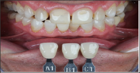 Click here to view Large Figure 7