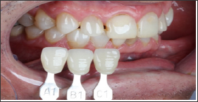 Click here to view Large Figure 8