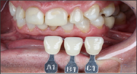 Click here to view Large Figure 9