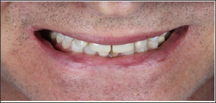 Click here to view Large Figure 11