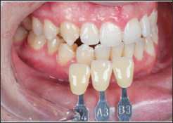 Click here to view Large Figure 14