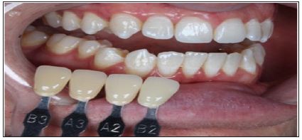 Click here to view Large Figure 19