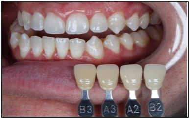 Click here to view Large Figure 20