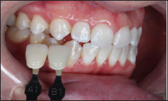 Click here to view Large Figure 21