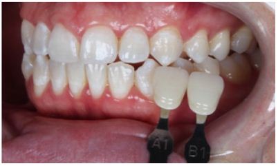 Click here to view Large Figure 22