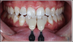 Click here to view Large Figure 23