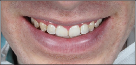 Click here to view Large Figure 24