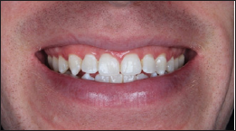 Click here to view Large Figure 25