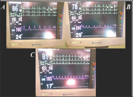 Click here to view Large Figure 1