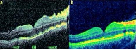 Click here to view Large Figure 1