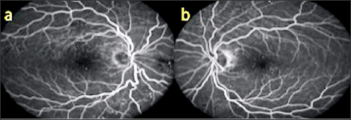 Click here to view Large Figure 1