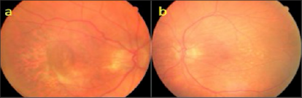 Click here to view Large Figure 11