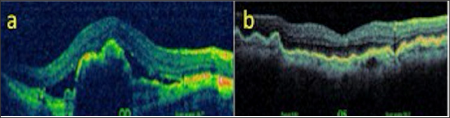 Click here to view Large Figure 12
