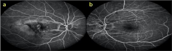 Click here to view Large Figure 13