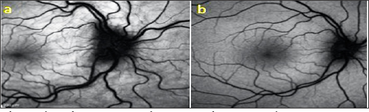 Click here to view Large Figure 3