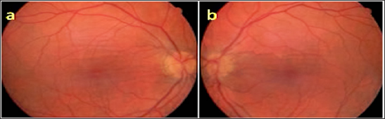 Click here to view Large Figure 5