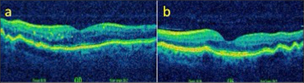 Click here to view Large Figure 9