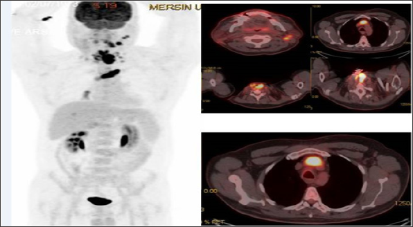 Click here to view Large Figure 1