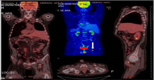 Click here to view Large Figure 2