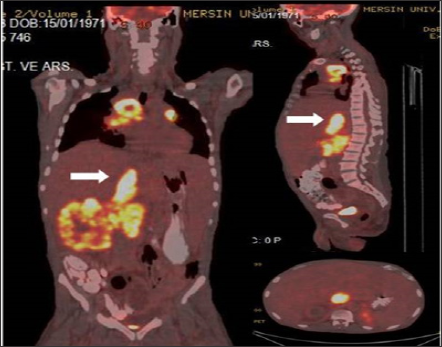 Click here to view Large Figure 3