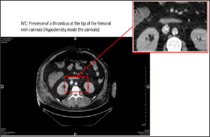 Click here to view Large Figure 1