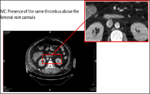 Click here to view Large Figure 2