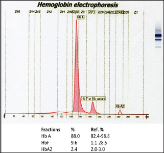 Click here to view Large Figure 2