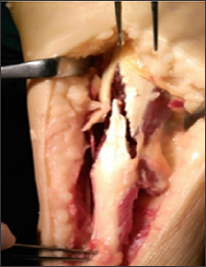 Click here to view Large Figure 4