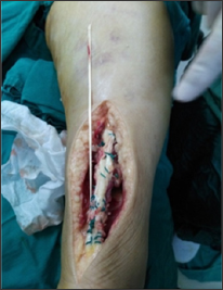 Click here to view Large Figure 5