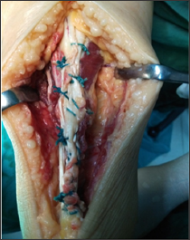 Click here to view Large Figure 6