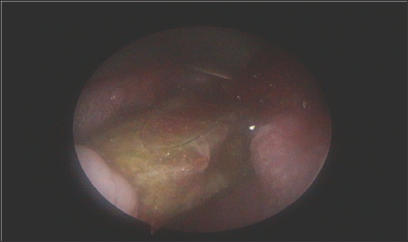 Click here to view Large Figure 1