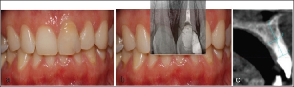 Click here to view Large Figure 1